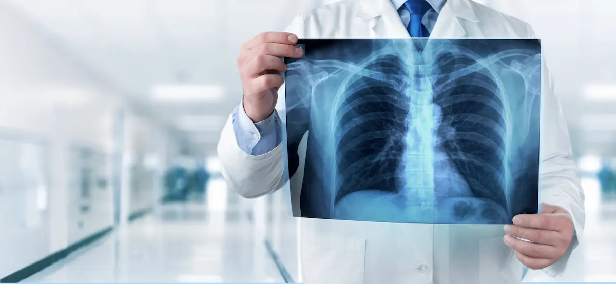 médico avaliando exame após espirometria