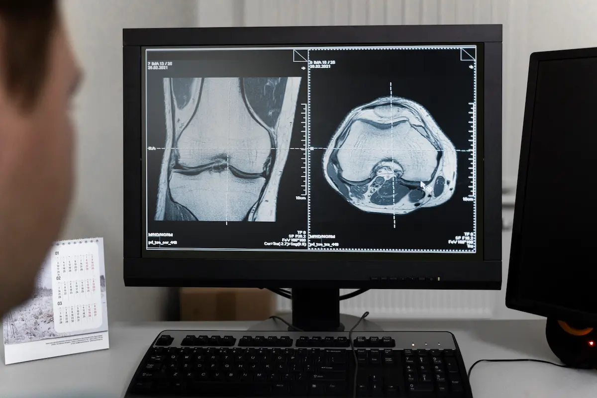 radiologista analisando exame por aplicações de telerradiologia radiologista analisando exame por aplicações de telerradiologia