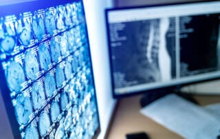 pratica de telerradiologia nuclear