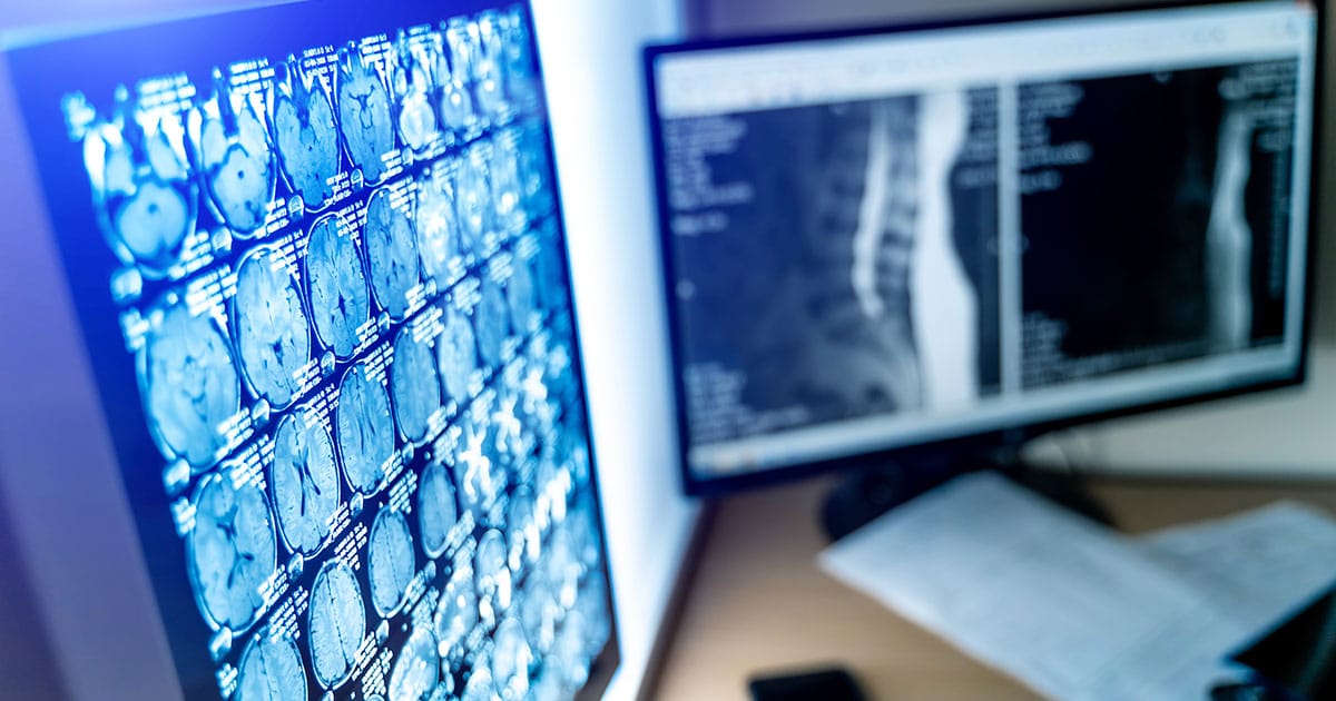 pratica-de-telerradiologia-nuclear pratica de telerradiologia nuclear