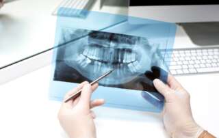 médico analisando imagem de radiologia odontológica