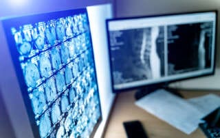 Monitor exibindo exames em um sistema PACS.