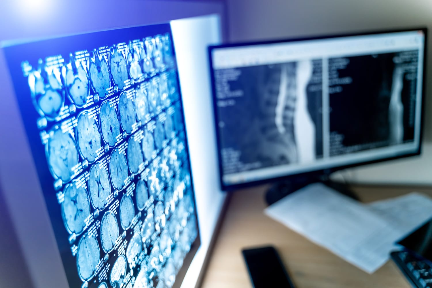 monitor exibindo exames em um sistema pacs Monitor exibindo exames em um sistema PACS.