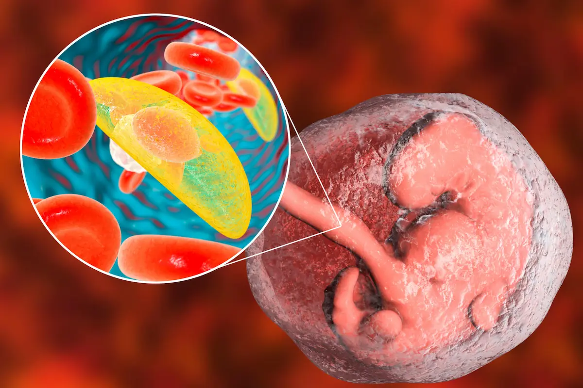 transmissao-de-parasitas de toxoplasma gondii para o feto