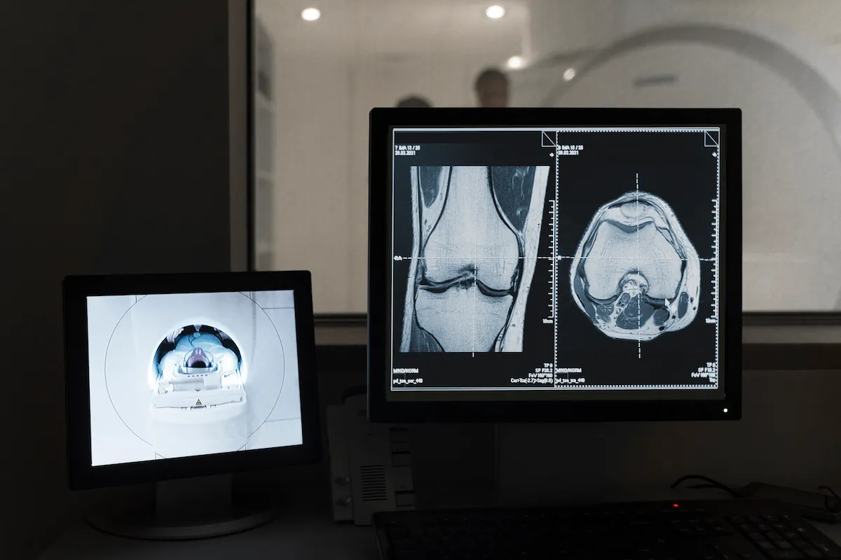 exame sendo realizado em uma clínica de radiologia