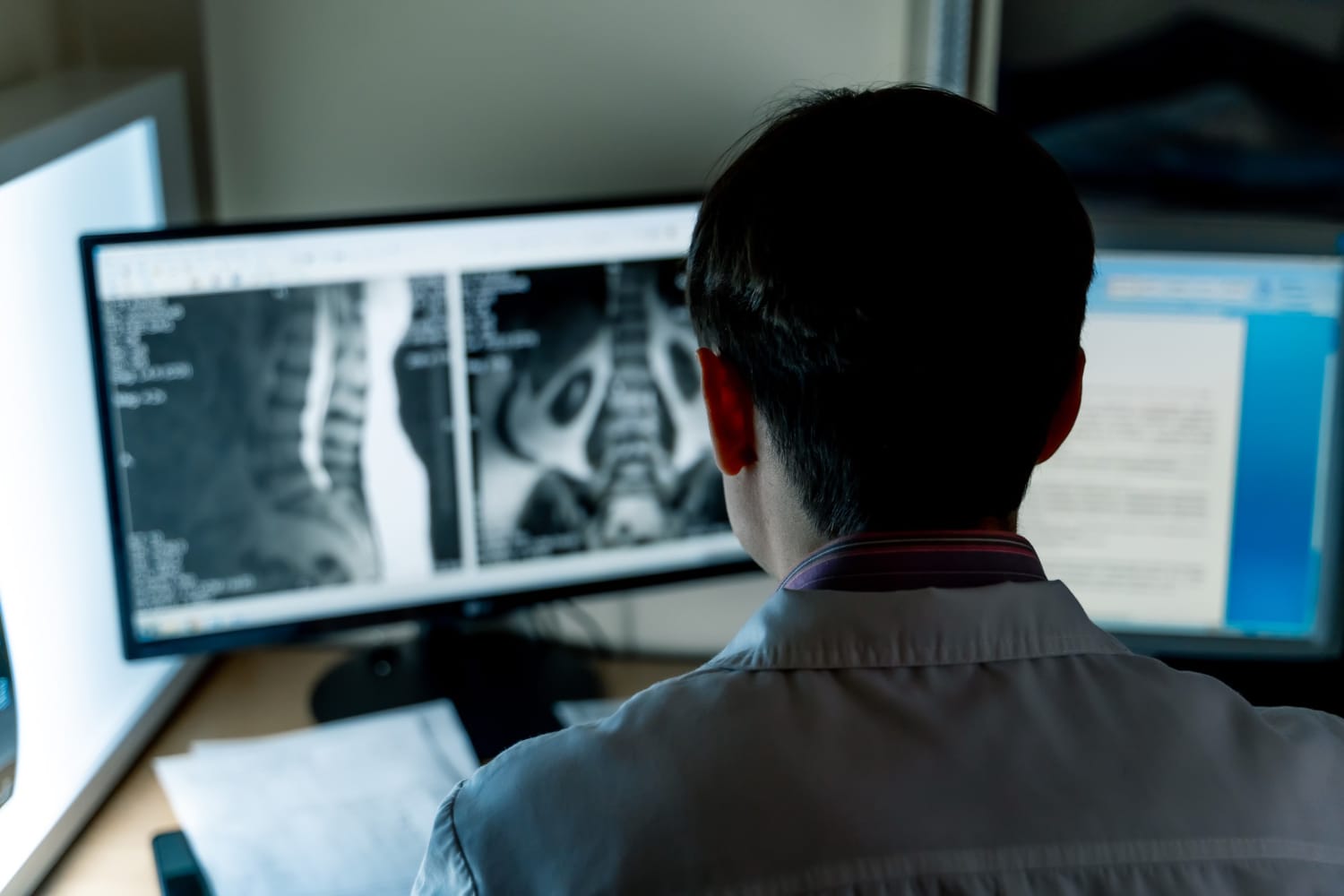 medico radiologista analisando exame para telerradiologia medico radiologista analisando exame para telerradiologia