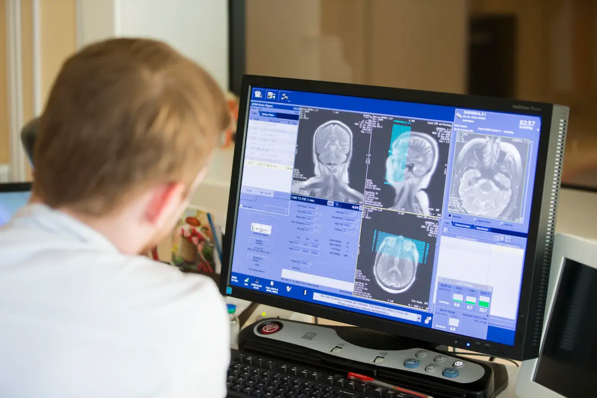 medico utilizando IA para segunda impressão em exame